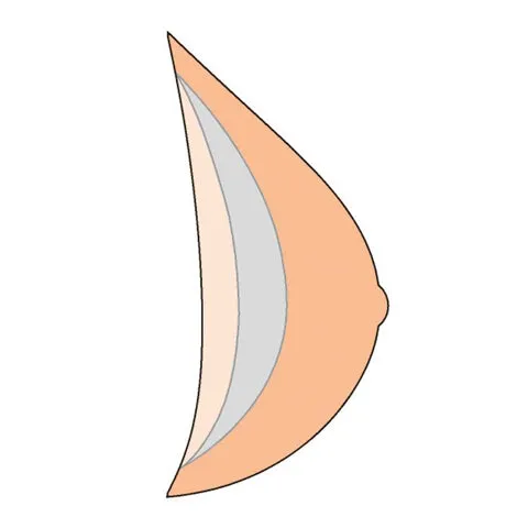 Amoena Natura Light 2S Breast Form